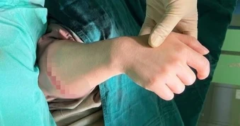 Khoảnh khắc cẳng tay được nối liền kỳ diệu, khi 6 giờ trước còn đứt lìa