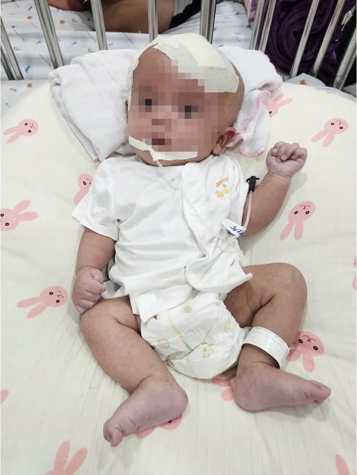Khối u to trong não bé gái được bác sĩ phẫu thuật thành công Khối u to trong não bé gái được bác sĩ phẫu thuật thành công