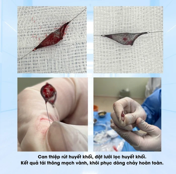 Kịp giữ lại mạng sống cho tài xế bất ngờ tím tái, ngưng thở Kịp giữ lại mạng sống cho tài xế bất ngờ tím tái, ngưng thở
