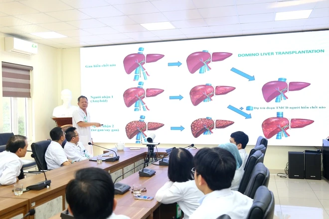 Lần đầu Việt Nam ghép tạng domino: Người nhận gan hiến lại, cứu thêm bệnh nhân
