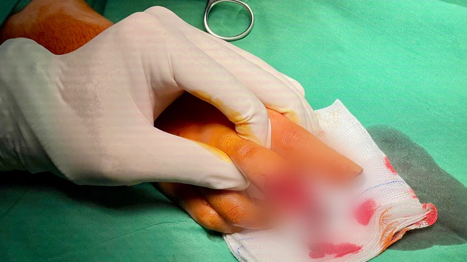 Liên tiếp các ca tai nạn lao động được cấp cứu kịp thời Liên tiếp các ca tai nạn lao động được cấp cứu kịp thời