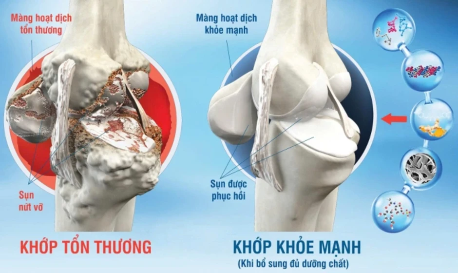 Lưu ý đi giày cao gót tránh hại xương khớp - Báo TinVina Lưu ý đi giày cao gót tránh hại xương khớp - Báo TinVina