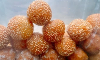Lý do người gầy vẫn bị gan nhiễm mỡ