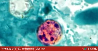Mỹ ghi nhận ca tử vong đầu tiên liên quan đến đợt dịch Cyclospora