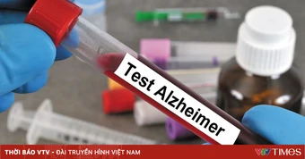Mỹ phát triển phương pháp xét nghiệm máu giúp phát hiện sớm bệnh Alzheimer