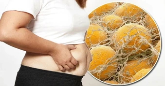 Mãi không giảm được mỡ bụng, có thể bạn đang mắc 12 sai lầm này