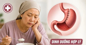 Mệt mỏi, sụt cân sau điều trị ung thư: Khi nào đáng lo?