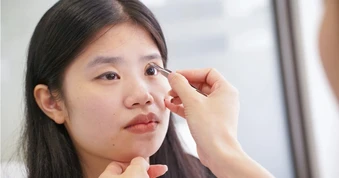 Mí mắt phẫu thuật thẩm mỹ bị lỗi có sửa được không?