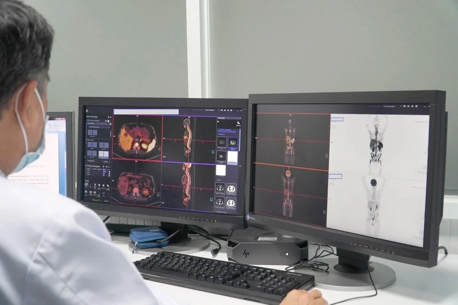 Miền Nam hơn 1 năm không thể chụp PET/CT: Khi nào lò cyclotron hoạt động?