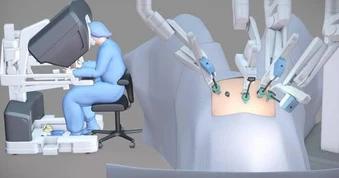 Mổ bằng robot có thực sự tốt hơn không?