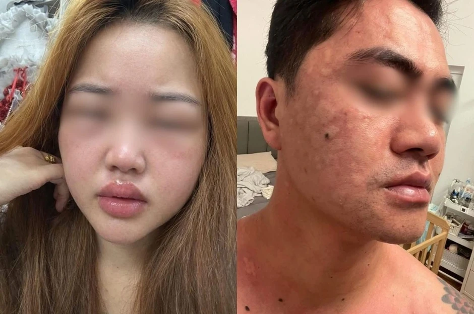 Món bánh trứng kiến gây sốt: Nhiều người dị ứng ngay sau khi thử Món bánh trứng kiến gây sốt: Nhiều người dị ứng ngay sau khi thử