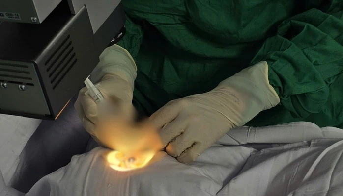 Một trường hợp cấp cứu hi hữu: bệnh nhân bị ong chích xuyên giác mạc Một trường hợp cấp cứu hi hữu: bệnh nhân bị ong chích xuyên giác mạc