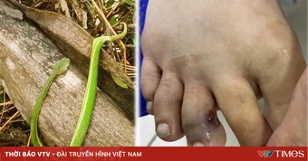 Mùa hè, cảnh giác rắn lục đuôi đỏ cắn trẻ nhỏ