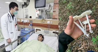 Nấm độc khó phân biệt bằng mắt thường, chuyên gia khuyến cáo tuyệt đối không ăn