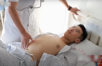 Nam sinh 15 tuổi nôn ra máu, nội soi thấy "sỏi dạ dày": 80% các trường hợp ung thư dạ dày có liên quan