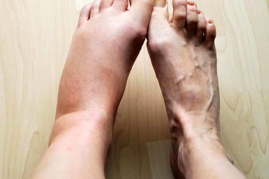 Nếu có đủ 4 thứ trên bàn chân thì xin chúc mừng! Thận của bạn khả năng cao vẫn còn rất khỏe Nếu có đủ 4 thứ trên bàn chân thì xin chúc mừng! Thận của bạn khả năng cao vẫn còn rất khỏe