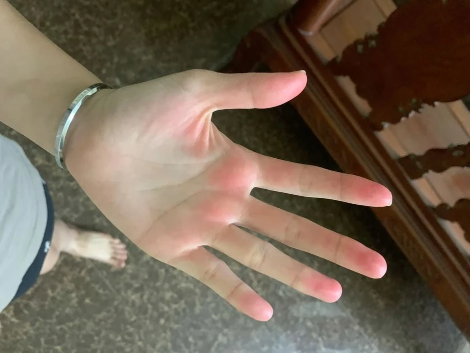 Nếu có đủ 5 thứ trên bàn tay thì xin chúc mừng! Gan của bạn khả năng cao vẫn còn rất khỏe Nếu có đủ 5 thứ trên bàn tay thì xin chúc mừng! Gan của bạn khả năng cao vẫn còn rất khỏe