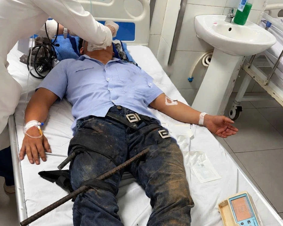 Ngã xe máy vào công trình, người đàn ông bị 2 thanh sắt đâm xuyên cơ thể Ngã xe máy vào công trình, người đàn ông bị 2 thanh sắt đâm xuyên cơ thể