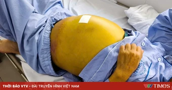 Ngày 28/7: Chung tay loại trừ viêm gan virus