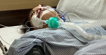 Ngày càng có nhiều người trẻ mắc ung thư đại trực tràng, các chuyên gia nói: Ăn thêm 5 thứ để "tự cứu lấy mình"