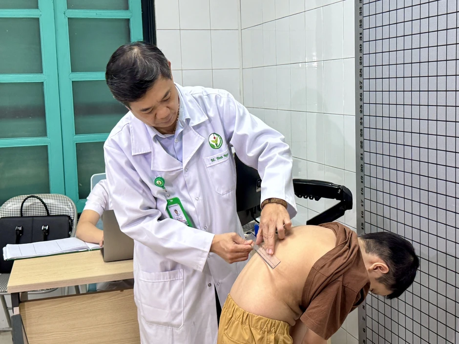 Nghĩ lệch vai nhẹ, nhiều trẻ vẹo cột sống nặng: Bác sĩ chỉ cách phát hiện Nghĩ lệch vai nhẹ, nhiều trẻ vẹo cột sống nặng: Bác sĩ chỉ cách phát hiện