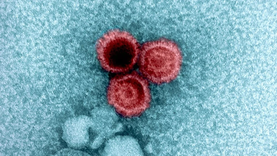 Nghiên cứu hé lộ lý do một số virus ẩn náu bên trong cơ thể bạn suốt đời