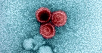 Nghiên cứu hé lộ lý do một số virus ẩn náu bên trong cơ thể bạn suốt đời
