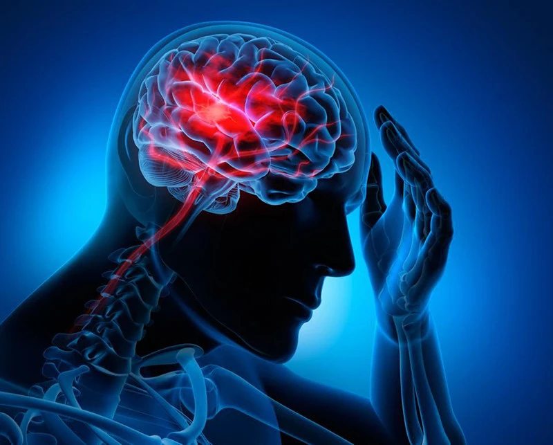 Nghiên cứu mới ghi nhận ĐỘT QUỴ ở người trẻ TĂNG 83% trong gần 30 năm: Các nhà khoa học vẫn chưa tìm ra lời giải Nghiên cứu mới ghi nhận ĐỘT QUỴ ở người trẻ TĂNG 83% trong gần 30 năm: Các nhà khoa học vẫn chưa tìm ra lời giải
