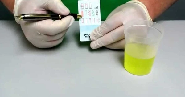 Ngọc Sơn tự đi xét nghiệm ma túy: Chuyên gia, bác sĩ nói gì về độ chính xác của từng phương pháp? Ngọc Sơn tự đi xét nghiệm ma túy: Chuyên gia, bác sĩ nói gì về độ chính xác của từng phương pháp?