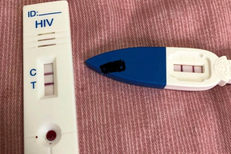 Người đàn ông 30 tuổi bất ngờ phát hiện nhiễm HIV khi đi khám mắt, bác sĩ: Đừng xem nhẹ 4 điều! Người đàn ông 30 tuổi bất ngờ phát hiện nhiễm HIV khi đi khám mắt, bác sĩ: Đừng xem nhẹ 4 điều!