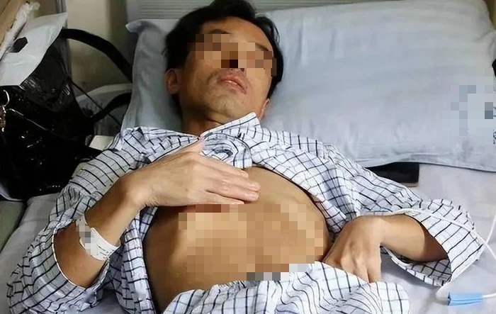 Người đàn ông 53 tuổi nhận "án tử" ung thư gan, bác sĩ tức giận: Đừng làm việc này quá 3 lần 1 tháng! Người đàn ông 53 tuổi nhận "án tử" ung thư gan, bác sĩ tức giận: Đừng làm việc này quá 3 lần 1 tháng!