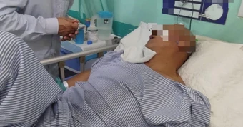 Người đàn ông 54 tuổi tử vong vì đột quỵ, bác sĩ nói với người nhà: "Ngủ trưa thế này khác gì phá mạch máu?"