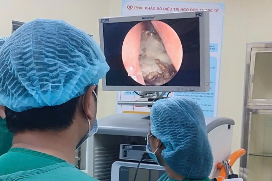 Người đàn ông bị nấm xoang gây hoại tử và phá hủy xương vùng mũi Người đàn ông bị nấm xoang gây hoại tử và phá hủy xương vùng mũi
