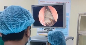 Người đàn ông bị nấm xoang gây hoại tử và phá hủy xương vùng mũi
