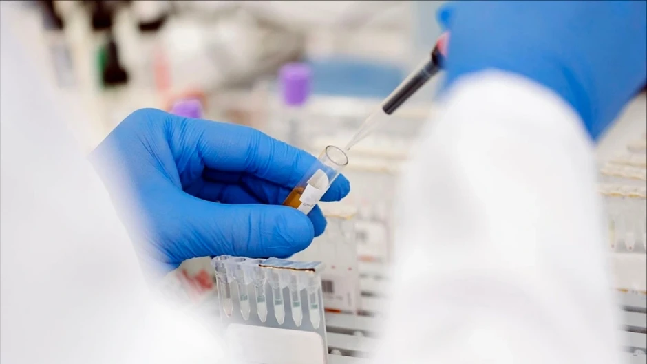 Người đàn ông Na Uy khỏi HIV sau ca ghép tế bào gốc từ anh trai mang gen lạ Người đàn ông Na Uy khỏi HIV sau ca ghép tế bào gốc từ anh trai mang gen lạ