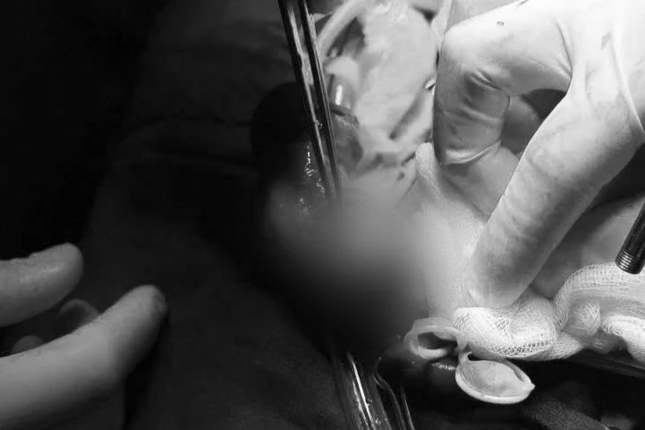 Người đàn ông nhập viện trong tình trạng tai nạn nam khoa nghiêm trọng Người đàn ông nhập viện trong tình trạng tai nạn nam khoa nghiêm trọng
