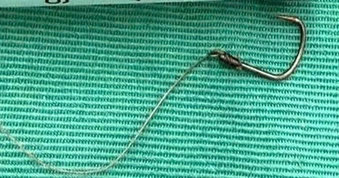 Người đàn ông ở Đà Nẵng nuốt phải lưỡi câu khi ăn cá