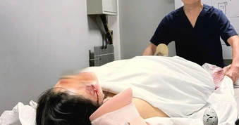 Người phụ nữ mắc kẹt dưới gầm xe buýt bị gãy xương