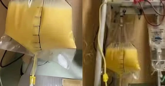 Người phụ nữ ra "máu trắng như sữa", bác sĩ lên tiếng cảnh báo