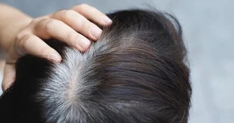 Người trẻ tóc bạc sớm: Bác sĩ chỉ ra 3 dưỡng chất hay bị thiếu hụt, ít người để ý đến