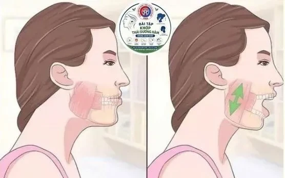 Nguy hiểm cơn đau hàm mặt kéo dài Nguy hiểm cơn đau hàm mặt kéo dài