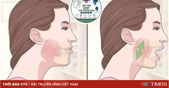 Nguy hiểm cơn đau hàm mặt kéo dài