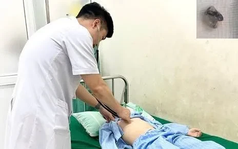 Nguy hiểm: Nhổ răng tại nhà, bé trai nguy kịch vì răng rơi vào phổi Nguy hiểm: Nhổ răng tại nhà, bé trai nguy kịch vì răng rơi vào phổi