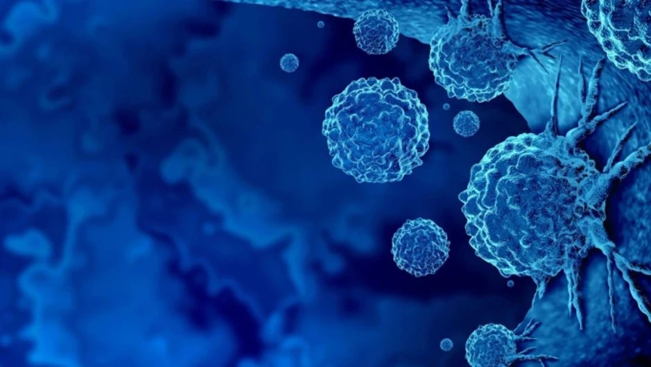 Nhà khoa học Nga tạo virus diệt ung thư không hại tế bào lành Nhà khoa học Nga tạo virus diệt ung thư không hại tế bào lành