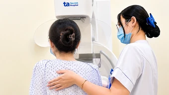 Nhân vú tiến triển ung thư - Báo TinVina