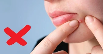 Nhiều chị em ở TPHCM bị nhiễm trùng, mặt sưng nề biến dạng vì tự nặn mụn