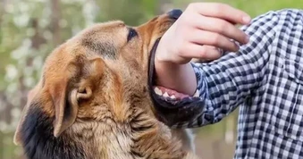 Nhiều người bị chó nghi dại cắn, TPHCM phát cảnh báo khẩn