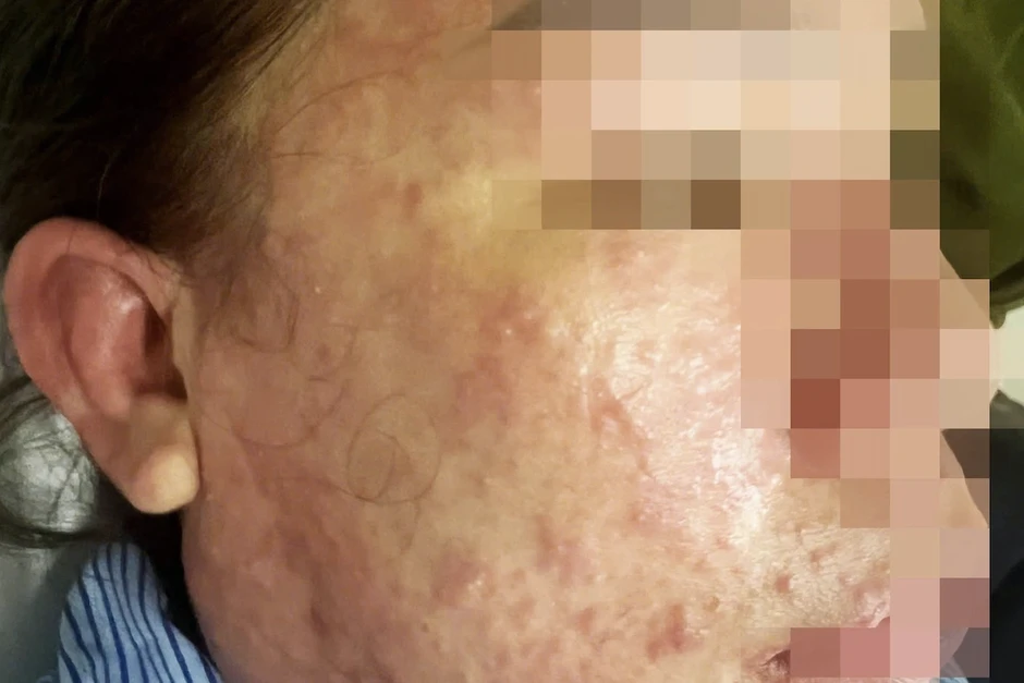 Nhiều người Việt không chịu nhận béo phì, chỉ thấy "hơi thừa cân một chút"