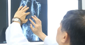 Nhiều trẻ vẹo cột sống nặng mới đi khám, chuyên gia cảnh báo nguy cơ biến chứng nặng