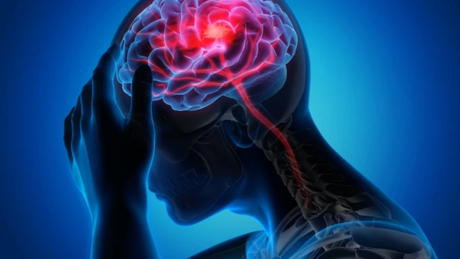 Nhìn thấy chữ nhưng không đọc được - dấu hiệu đột quỵ nguy hiểm